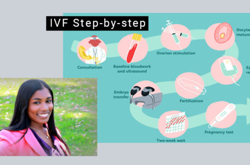 IVF Step-by-step